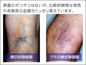 ��p�O�ˎ�p�� 